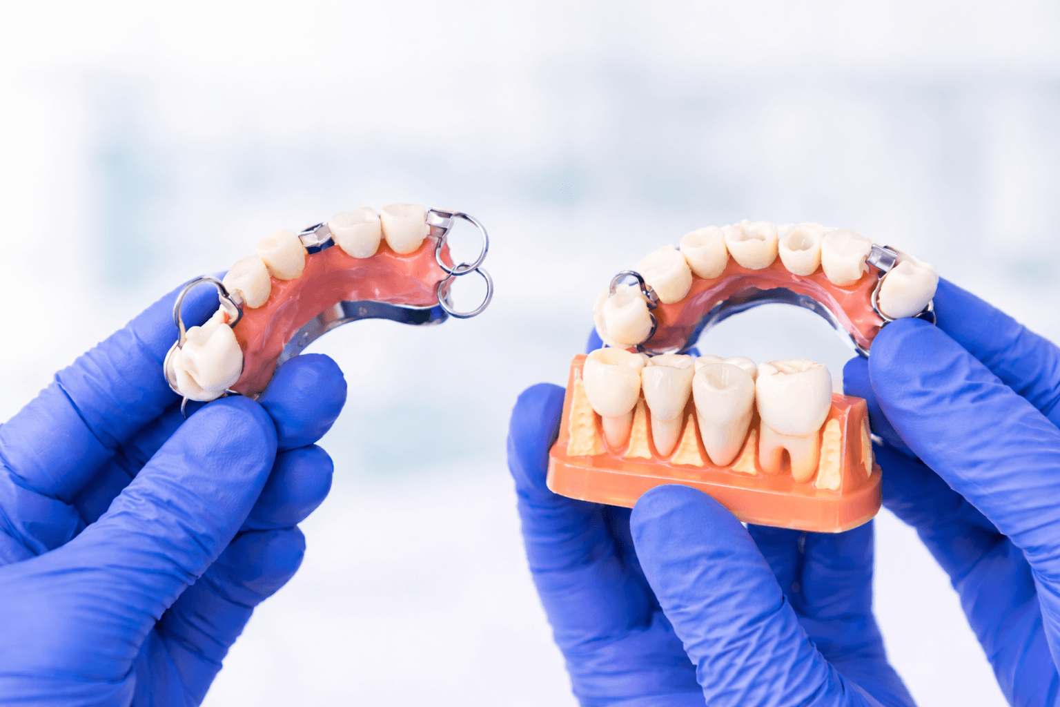Dentures